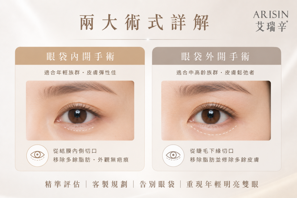 Lower Blepharoplasty 眼袋手術 4 0004