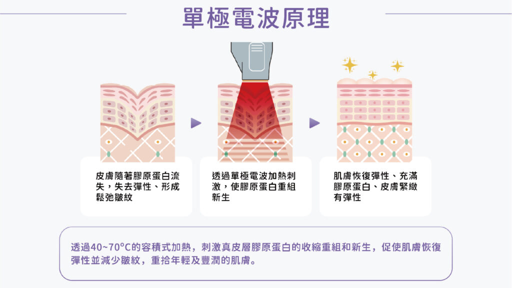 10 THERMA – Sóng điện từ Tenbei | Sóng điện từ gấp 10 lần 5 十蓓電波 十倍電波 台中十蓓電波