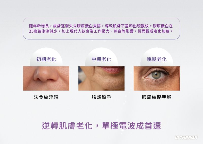 10 THERMA 十蓓電波介紹1