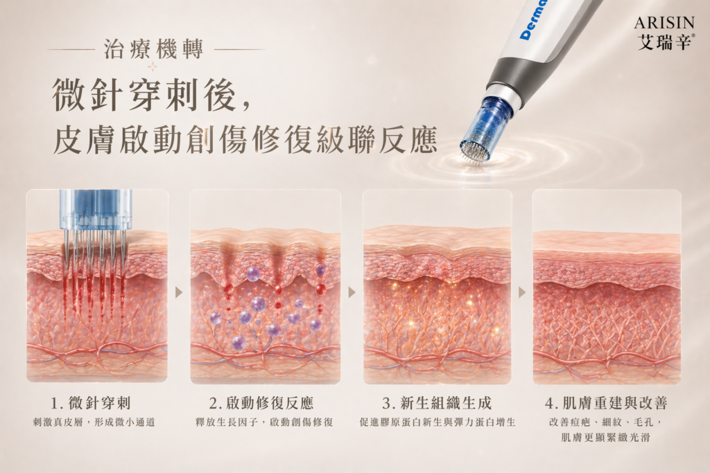 Dermapen 4 得美微針筆 3 ChatGPT Image 2026年4月23日 下午07 41 54