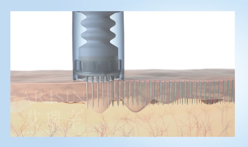 Dermapen 4 得美微針筆3