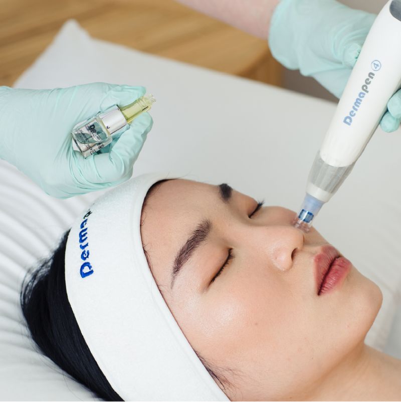 Dermapen 4 得美微針筆6