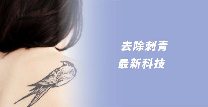 Discovery Pico 探索皮秒雷射5