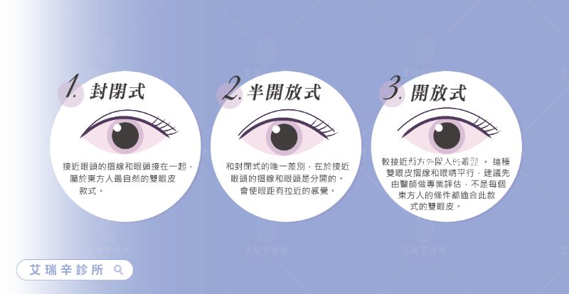 Eye Surgery雙眼皮12