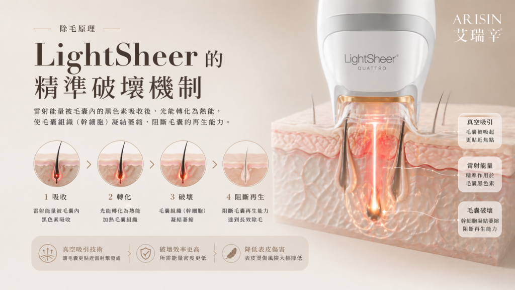 LightSheer 第三代真空除毛 4 LightSheer 第三代真空除毛03
