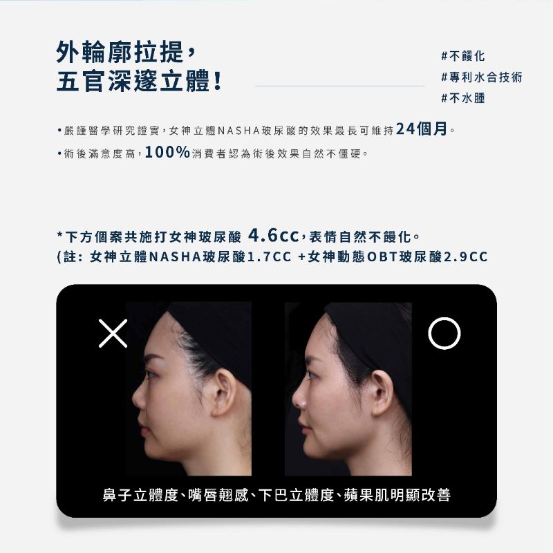 Restylane瑞絲朗玻尿酸 介紹 8