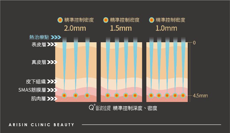 ULTRAcel Q+音波拉提2