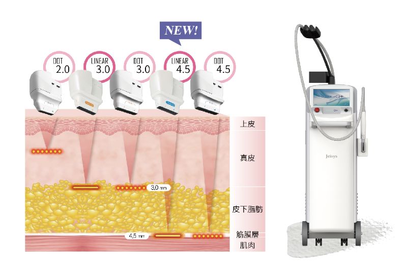 ULTRAcel Q+音波拉提5