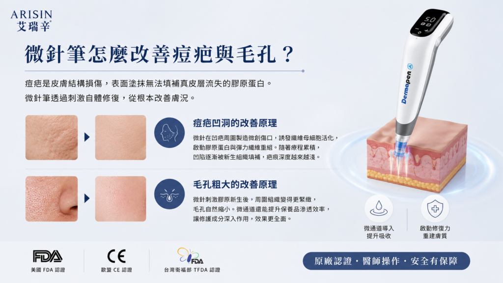 Dermapen 4 微針筆是什麼?痘疤、毛孔粗大怎麼改善?艾瑞辛診所完整解析 1 300
