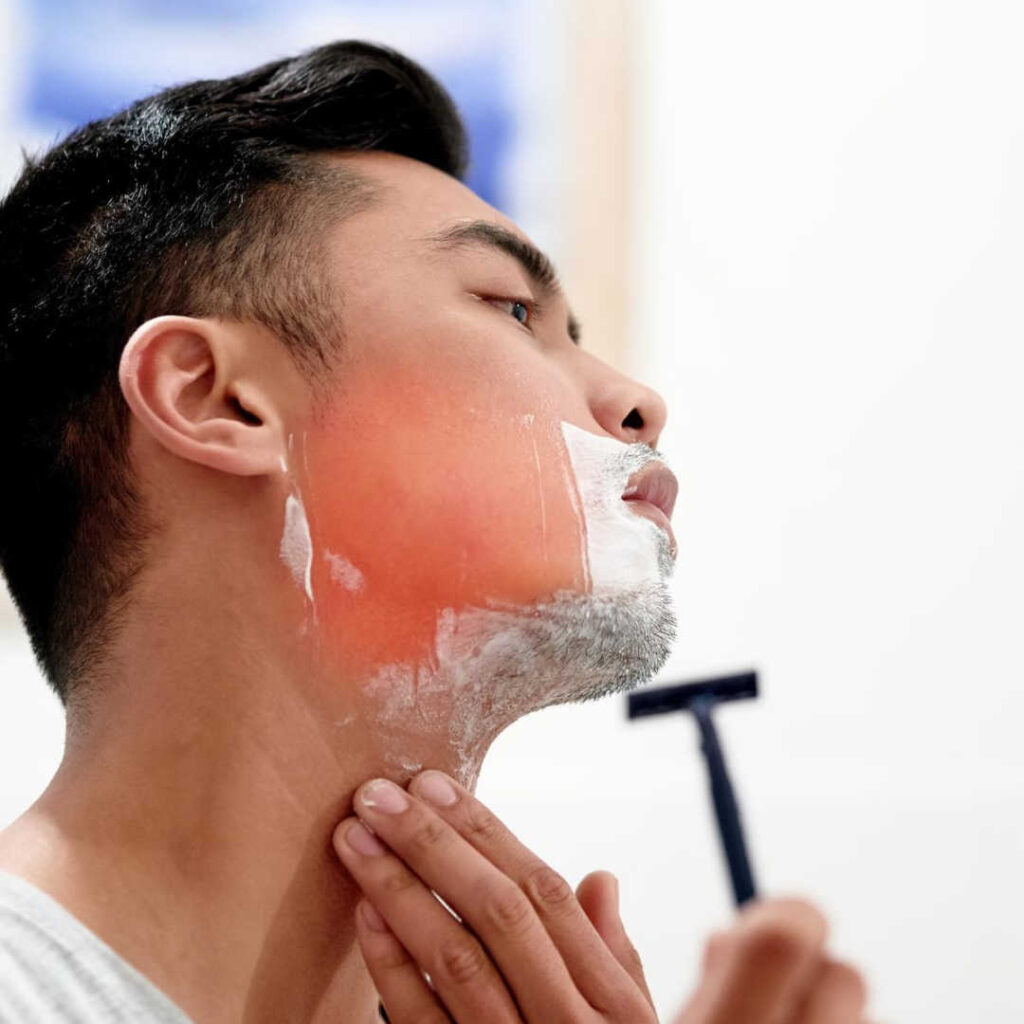 刮鬍子,刮到什麼時候?男生鬍子雷射除毛完整攻略 1 48425544 razor burn cropped