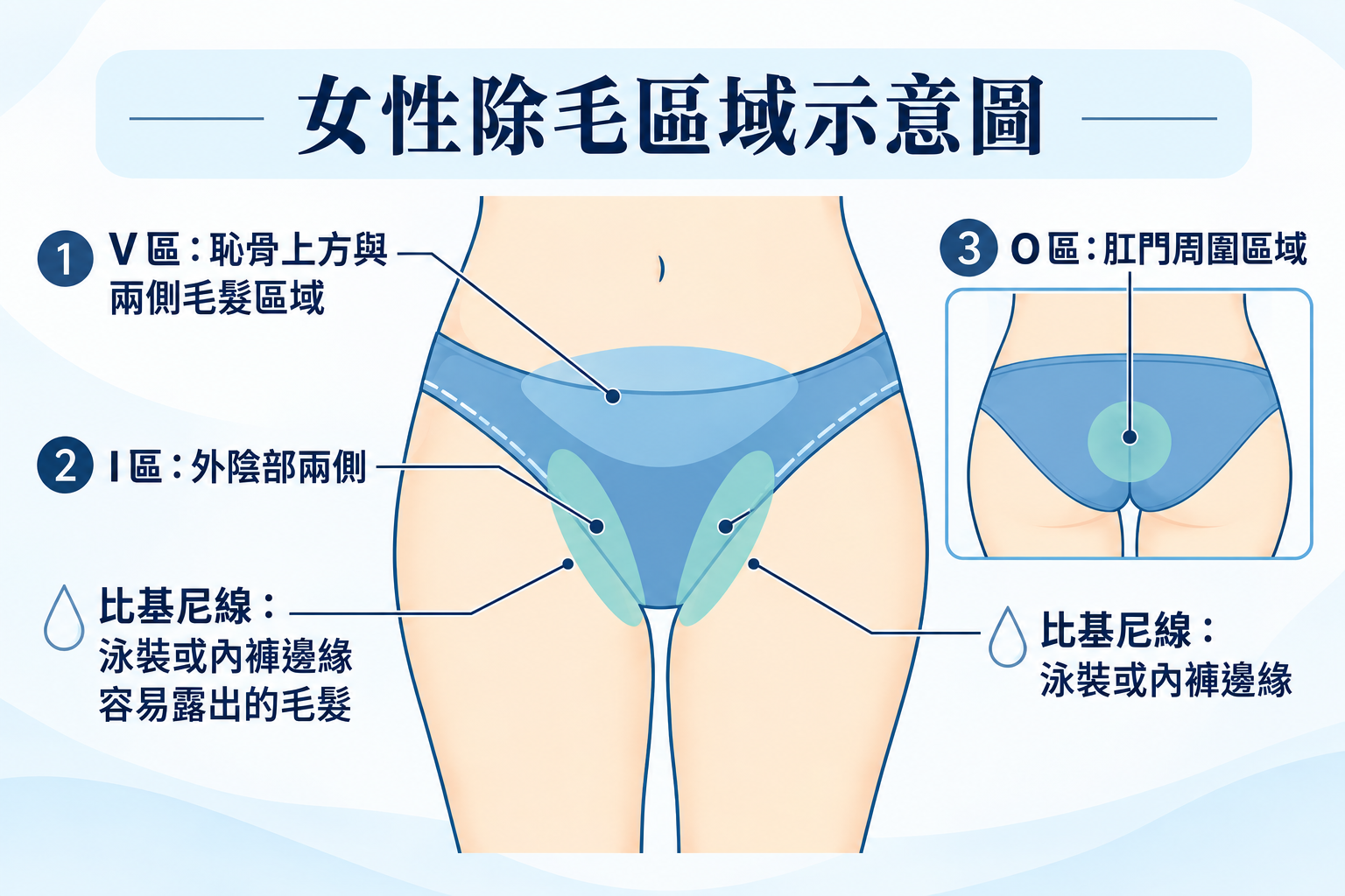 私密處除毛怎麼選?VIO部位、5種除毛方式與雷射除毛一次看 1 女性私密處VIO除毛區域示意圖:V區、I區、O區與比基尼線